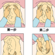 胎兒臀位(胎兒臂位) 胎兒臀位(胎兒臂位)