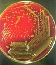銅綠假單胞菌