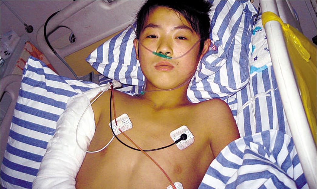 陳浩打著石膏躺在病床上接受治療