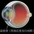 眼盲 眼盲
