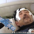 剝皮父母 剝皮父母