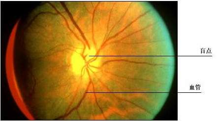 視網膜震盪