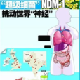 NDM-1細菌 NDM-1細菌